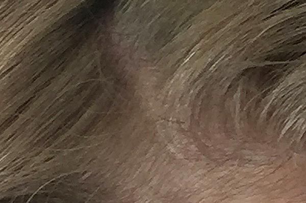 dünne haare kaschieren mit haarverdichtung spray