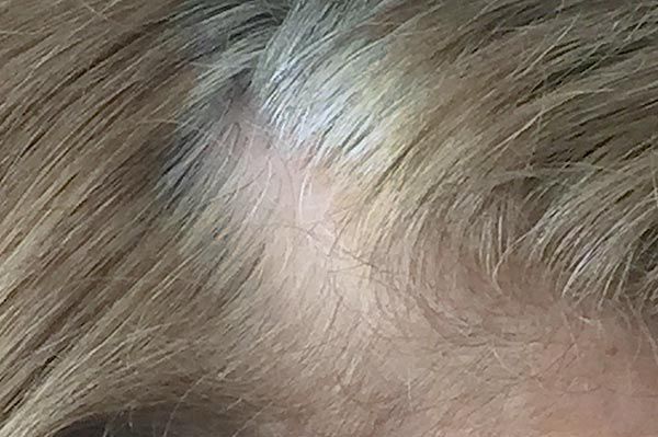 problem dünne haare - bild 1