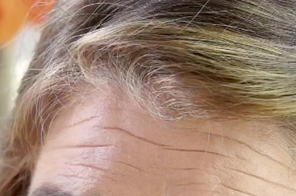 haarproblem grauer haaransatz - bild 1