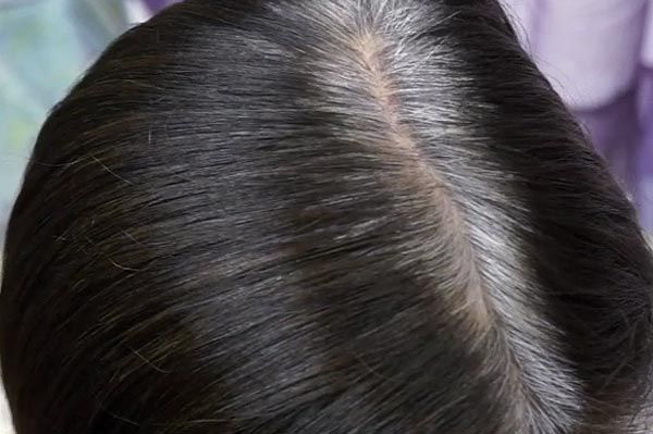 haarproblem grauer scheitel - bild 1