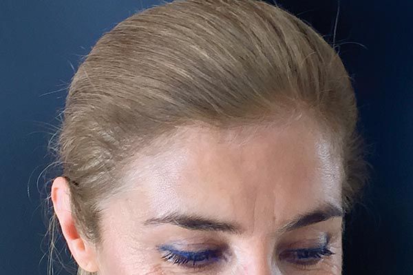 haaransatz perfekt kaschiert mit salon in a bottle