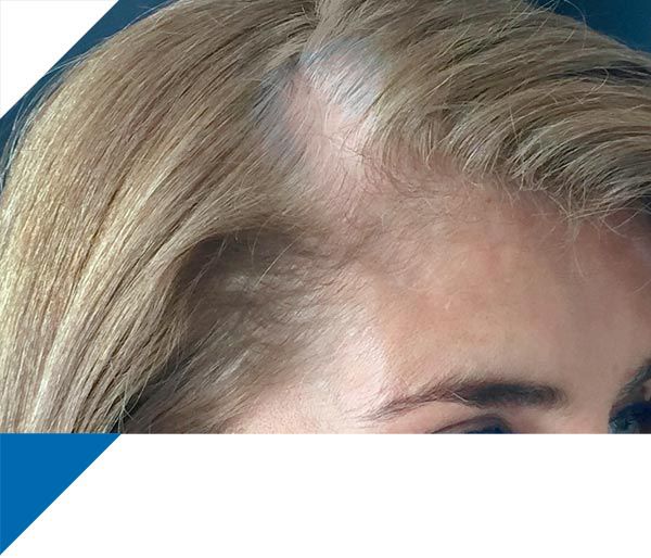 haarverdichtungsspray für dünnes haar - salon in a bottle