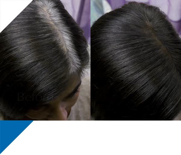 haarverdichtungsspray wirkung - salon in a bottle